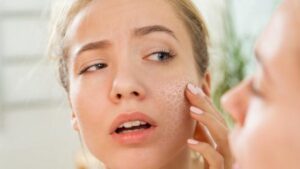 جفاف الجسم في الصيف